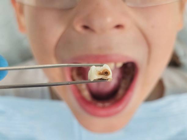 Best Pediatric Emergency Dentist in Howard Lake, MN
